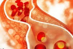 Врачи назвали простые способы снизить уровень холестерина
