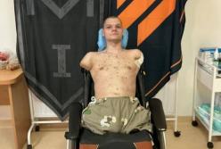 "ПриватБанк" після відмови видати картку ветерану без рук відкуповується: пропонує протезування та лікування