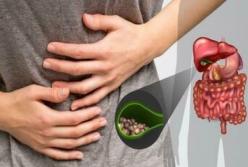 Названы первые признаки появления желчных камней