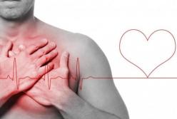 Медики рассказали, кто находится в зоне риска развития аритмии 