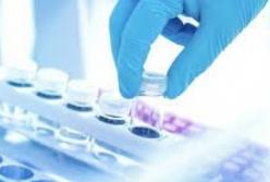 В Украине 876 новых случаев COVID-19