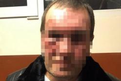 В Киеве мужчине прострелили ногу из-за некачественного ремонта