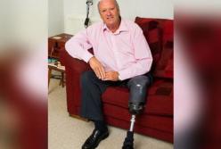 Обычный волдырь привел к ампутации ноги у мужчины