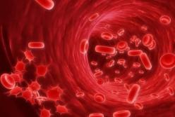 Медики перечислили часто игнорируемые признаки рака крови