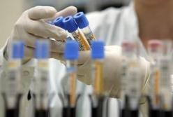 В Украине появятся тест-системы для ускоренного диагностирования коронавируса