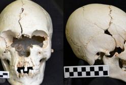 На необитаемом острове обнаружили 200-летний череп прокаженного