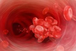 Врачи назвали главные симптомы тромбов