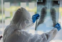 Искусственный интеллект научили "диагностировать" коронавирус по кашлю