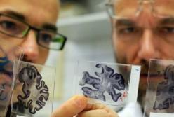 Найдено средство, что остановит старение мозга и улучшит память