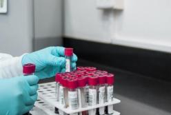 Экс-сотрудница института биотехнологий в Киеве похитила опасные штаммы вируса