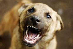 На Київщині сусідський пес напав на 7-річного хлопчика і 8-річну дівчинку, вони у лікарні