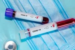 Новые случаи коронавируса в Украине: в Радомышле принимают чрезвычайные меры