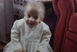 В Луцке от старости умерла восьмилетняя девочка