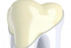 Ученые создали зубную эмаль, которая тверже и прочнее настоящей