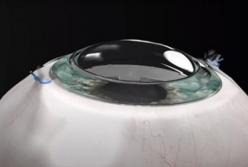 Ученые смогли за сутки восстановить зрение у слепого пациента