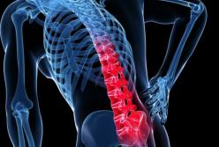 Ученые установили главную причину хронических болей в спине 