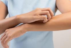 Названы кожные симптомы, сигнализирующие о повышенном сахаре в крови 