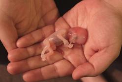 "Відмовитись від абортів навіть у приватних клініках": у рф готують росіянок до вічних пологів (відео)