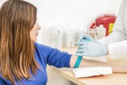 Разработан анализ крови, предсказывающий смерть в ближайшие 10 лет