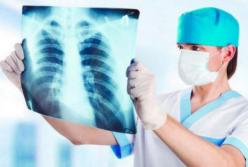 Медики назвали скрытые симптомы пневмонии