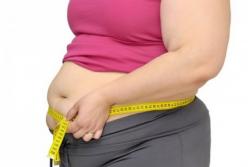 Названа процедура, необходимая людям с лишним весом