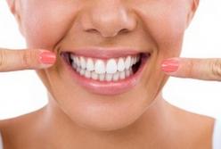 Врачи назвали продукты, разрушающие зубную эмаль