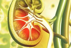 Врачи назвали продукты, которые провоцируют рост камней в почках 