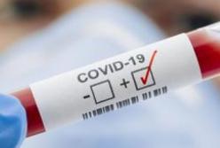 В Украине зафиксирована первая смерть от коронавируса