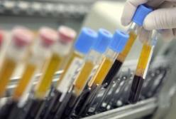 Ученые остановили рост рака и распространение метастаз