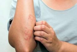 Виды и особенности применения дерматологических препаратов