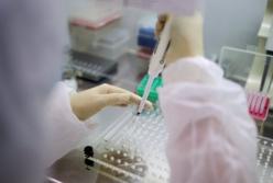 В Украине на следующей неделе планируют запустить массовое тестирование на антитела к COVID-19 (видео)