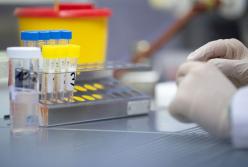 В украинских аптеках появятся тесты на коронавирус: сколько они будут стоить