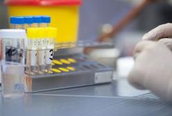 В Украине уже 54 тыс. случаев COVID-19, за сутки - 612