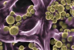 В Австралии обнаружили золотые грибы