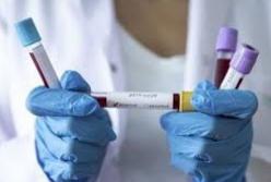 В Киеве зарегистрировали семь новых случаев заражения коронавирусом