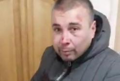 В Харькове избили директора парка «Юность» (видео)