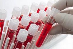 Ученые выяснили, какие болезни характерны для каждой группы крови 