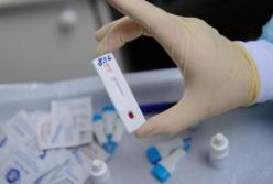 Число запросов о покупке теста на ВИЧ увеличилось в десятки раз после документального фильма Дудя