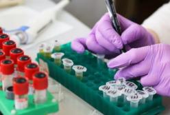 Какие анализы следует обязательно сдавать дважды в год: советы врача