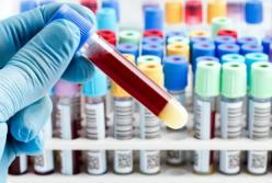 Ученые "вычислили" самую проблемную группу крови