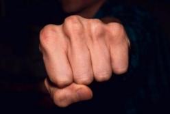 На Львовщине экс-нацгвардеец получил травмы во время "общения" с чиновником 