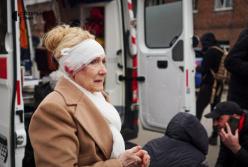 Ракетний удар по Сумах: серед понад 100 постраждалих 23 дитини (відео)