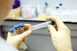 В Украине подтвердили 937 новых COVID-случаев за сутки