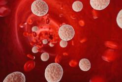 Как снизить риск сердечных заболеваний и уровень холестерина без лекарств: советы медиков