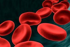 Названы симптомы, которые указывают на тромбоз