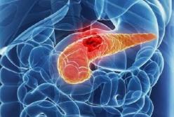Названы продукты-«враги» поджелудочной железы