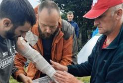 В Карпатах молния попала в туристов, есть пострадавшие