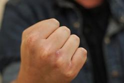 В Киеве мужчину вывезли в лес и ограбили (фото)