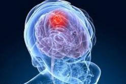 Врачи рассказали о главных симптомах рака головного мозга