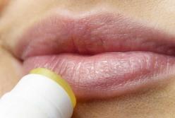 Медики назвали опасные последствия герпеса на губах